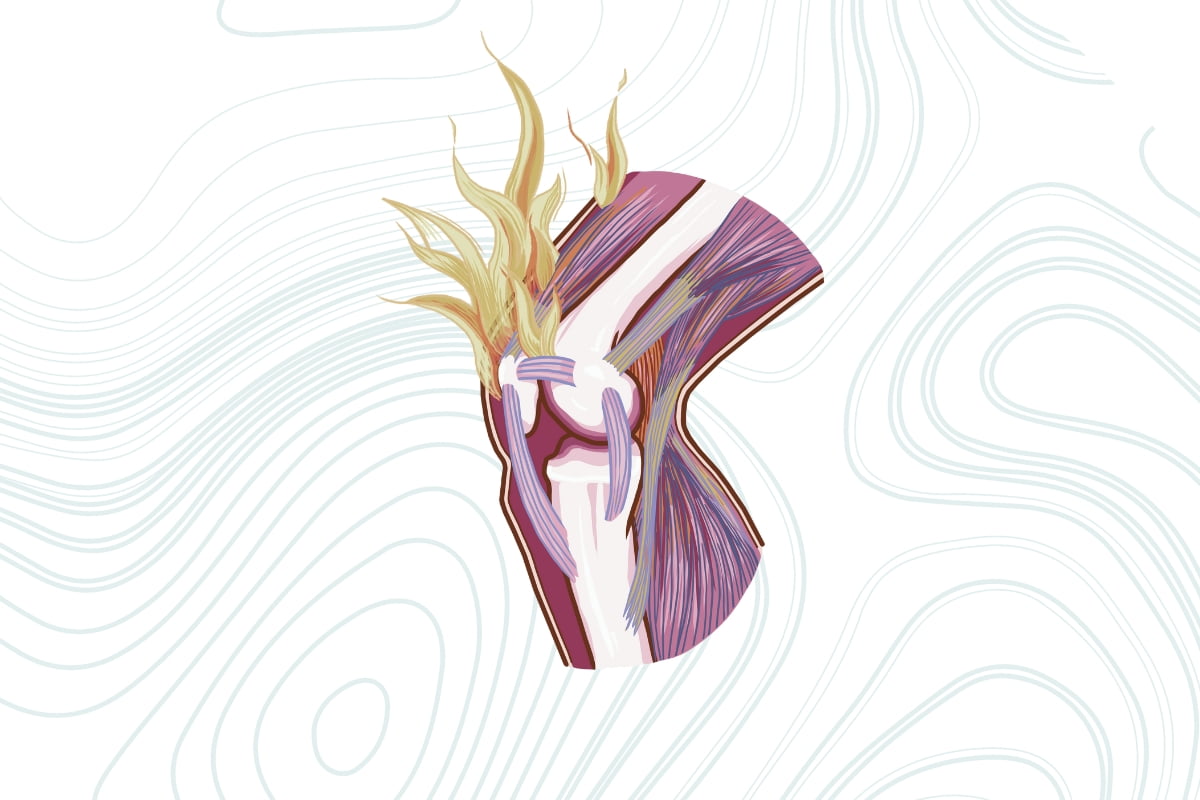 Comprendre et gérer les douleurs récentes avec l'ostéopathie: Conseils de Vincent Parisi sur la compréhension et la gestion des douleurs récentes par l'ostéopathie.